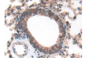 Immunohistochemistry (IHC) image for anti-Glial Fibrillary Acidic Protein (GFAP) (AA 108-211) antibody (ABIN7441994)