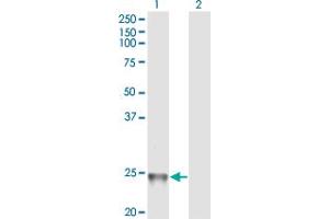 Western Blotting (WB) image for anti-RAB1B, Member RAS Oncogene Family (RAB1B) (AA 91-202) antibody (ABIN599595) (RAB1B 抗体  (AA 91-202))