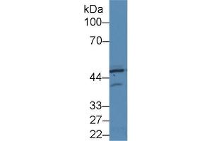 Western blot analysis of Human HeLa cell lysate, using Rat PKR Antibody (2 µg/ml) and HRP-conjugated Goat Anti-Rabbit antibody ( (EIF2AK2 抗体  (AA 279-506))