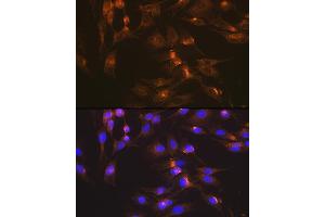Immunofluorescence (IF) image for anti-Solute Carrier Family 2 (Facilitated Glucose Transporter), Member 2 (SLC2A2) antibody (ABIN7270414)
