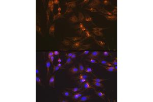 Immunofluorescence analysis of C6 cells using GLUT2/SLC2 Rabbit mAb (ABIN7270414) at dilution of 1:100 (40x lens). (SLC2A2 抗体)