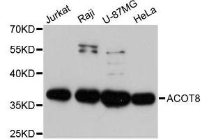 Western blot analysis of extracts of various cell lines, using ACOT8 antibody. (ACOT8 抗体  (AA 1-220))