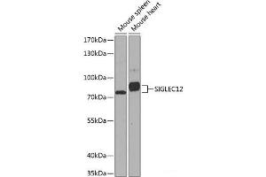 Western blot analysis of extracts of various cell lines using SIGLEC12 Polyclonal Antibody at dilution of 1:1000. (SIGLEC12 抗体)