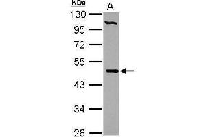 WB Image Sample (30 ug of whole cell lysate) A: HepG2 10% SDS PAGE antibody diluted at 1:1000 (PCYT2 抗体)