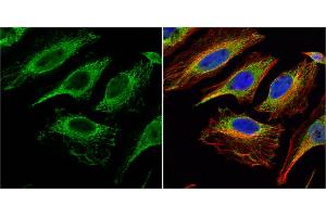 ICC/IF Image Citrate synthetase antibody [N2C3] detects Citrate synthetase protein at mitochondria by immunofluorescent analysis. (CS 抗体)