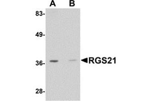 Western Blotting (WB) image for anti-Regulator of G-Protein Signaling 21 (RGS21) (Middle Region) antibody (ABIN1031060) (RGS21 抗体  (Middle Region))