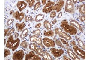 Image no. 2 for anti-TBC1 Domain Family, Member 13 (TBC1D13) antibody (ABIN1501310) (TBC1D13 抗体)