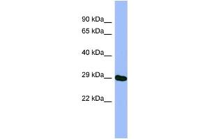 WB Suggested Anti-METTL5 Antibody Titration: 0. (METTL5 抗体  (N-Term))