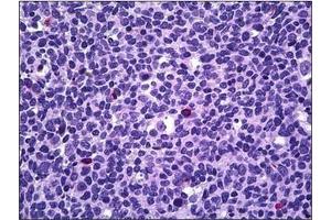 Human Tonsil, Lymphocytes: Formalin-Fixed, Paraffin-Embedded (FFPE) (PPP3CA 抗体  (N-Term))