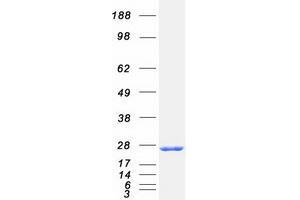 Western Blotting (WB) image for RAB4A, Member RAS Oncogene Family (RAB4A) protein (Myc-DYKDDDDK Tag) (ABIN2730358)