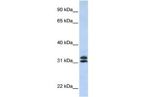 PYCR2 antibody used at 1 ug/ml to detect target protein. (PYCR2 抗体  (Middle Region))