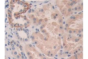 Immunohistochemistry (IHC) image for anti-Killer Cell Immunoglobulin-Like Receptor, Two Domains, Long Cytoplasmic Tail, 3 (KIR2DL3) (AA 22-342) antibody (ABIN1859538)