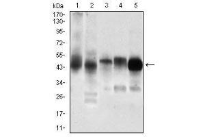 Western blot analysis using PDK2 mouse mAb against Jurkat (1), C6 (2), Cos7 (3), K562 (4), A431 (5) cell lysate. (PDK2 抗体  (AA 178-404))