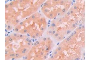 Detection of JAK2 in Human Kidney Tissue using Polyclonal Antibody to Janus Kinase 2 (JAK2) (JAK2 抗体  (AA 508-800))