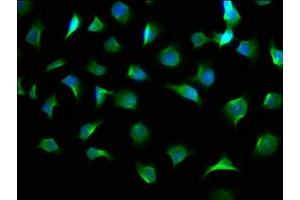 Immunofluorescence staining of A549 cells with ABIN7154202 at 1:100, counter-stained with DAPI. (AGL 抗体  (AA 1217-1378))