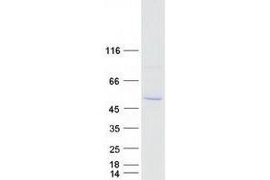 Western Blotting (WB) image for Cytochrome P450, Family 2, Subfamily A, Polypeptide 7 (CYP2A7) (Transcript Variant 2) protein (Myc-DYKDDDDK Tag) (ABIN2712762)