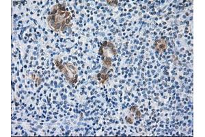 Immunohistochemical staining of paraffin-embedded Kidney tissue using anti-SORDmouse monoclonal antibody. (SORD 抗体)