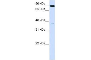 Synaptophysin antibody used at 1 ug/ml to detect target protein. (Synaptophysin 抗体  (N-Term))