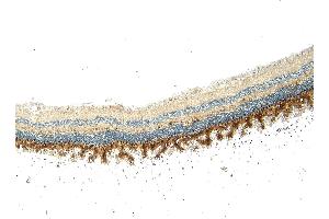 (ABIN570667) (5 μg/mL) staining of paraffin embedded Human Retina. (ARR3 抗体  (C-Term))