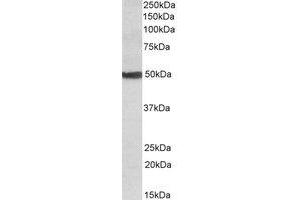 Western Blotting (WB) image for anti-Cytochrome P450, Family 24, Subfamily A, Polypeptide 1 (CYP24A1) (Internal Region) antibody (ABIN2464768) (CYP24A1 抗体  (Internal Region))