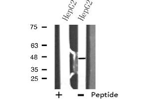 Western blot analysis of extracts from HepG2 cells using E2F2 antibody. (E2F2 抗体  (Internal Region))