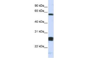 Western Blotting (WB) image for anti-Hyaluronan Binding Protein 2 (HABP2) antibody (ABIN2459800) (HABP2 抗体)