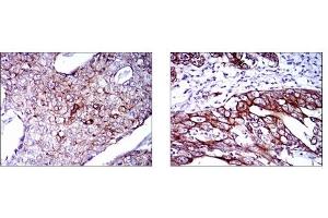Immunohistochemistry (IHC) image for anti-Keratin 5 (KRT5) antibody (ABIN1106933)