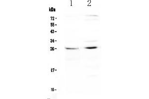 Western blot analysis of SLC31A1/CTR1 using anti-SLC31A1/CTR1 antibody . (SLC31A1 抗体)
