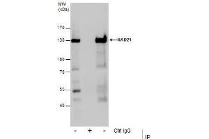 IP Image Immunoprecipitation of RAD21 protein from Jurkat whole cell extracts using 5 μg of RAD21 antibody, Western blot analysis was performed using RAD21 antibody, EasyBlot anti-Rabbit IgG  was used as a secondary reagent. (RAD21 抗体  (Center))