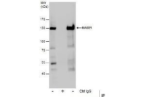 IP Image Immunoprecipitation of RAD21 protein from Jurkat whole cell extracts using 5 μg of RAD21 antibody, Western blot analysis was performed using RAD21 antibody, EasyBlot anti-Rabbit IgG  was used as a secondary reagent. (RAD21 抗体  (Center))