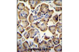 RADIL antibody immunohistochemistry analysis in formalin fixed and paraffin embedded human pancreas tissue followed by peroxidase conjugation of the secondary antibody and DAB staining. (Radil 抗体  (C-Term))