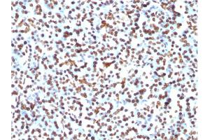Immunohistochemistry (IHC) image for anti-Histone H1 antibody (ABIN6939596)