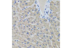 Immunohistochemistry of paraffin-embedded human liver using EIF2S3 antibody at dilution of 1:100 (x40 lens). (EIF2S3 抗体)