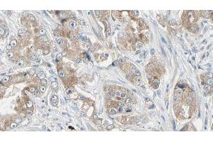 ABIN6279041 at 1/100 staining Human prostate tissue by IHC-P. (RPL18A 抗体  (Internal Region))