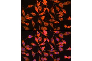 Immunofluorescence analysis of L929 cells using PITPNA Rabbit pAb (ABIN6132492, ABIN6145687, ABIN6145688 and ABIN6216795) at dilution of 1:100 (40x lens). (PITPNA 抗体  (AA 211-270))