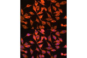 Immunofluorescence analysis of L929 cells using PITPNA Rabbit pAb (ABIN6132492, ABIN6145687, ABIN6145688 and ABIN6216795) at dilution of 1:100 (40x lens). (PITPNA 抗体  (AA 211-270))