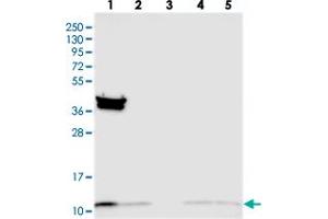 Western blot analysis of Lane 1: RT-4, Lane 2: U-251 MG, Lane 3: Human Plasma, Lane 4: Liver, Lane 5: Tonsil with TIMM10 polyclonal antibody  at 1:250-1:500 dilution. (TIMM10 抗体)