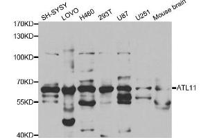 Western Blotting (WB) image for anti-Atlastin GTPase 1 (ATL1) antibody (ABIN1876490) (ATL1 抗体)