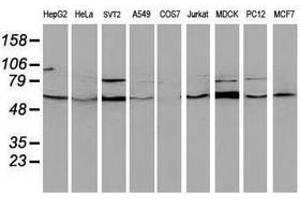 Image no. 4 for anti-Beclin 1, Autophagy Related (BECN1) antibody (ABIN1496868)