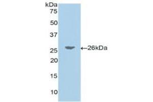 Western blot analysis of recombinant Human JAG1. (JAG1 抗体  (AA 33-250))