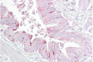 Immunohistochemistry with Lung, respiratory epithelium tissue at an antibody concentration of 5µg/ml using anti-PA2G4 antibody (ARP47601_P050) (PA2G4 抗体  (C-Term))