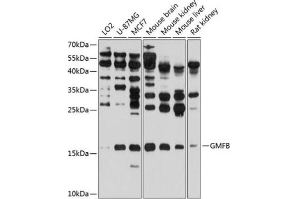 GMFB anticorps  (AA 1-140)