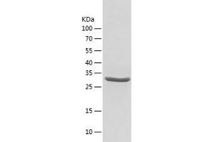 ADK Protein (AA 22-362) (His tag)