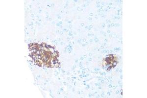 Immunohistochemistry (Paraffin-embedded Sections) (IHC (p)) image for anti-Ornithine Decarboxylase 1 (ODC1) (AA 1-280) antibody (ABIN3015744)