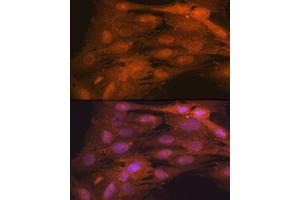 Immunofluorescence analysis of C6 cells using ISG15 Rabbit mAb (ABIN7268023) at dilution of 1:100 (40x lens).
