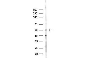 anti-Thymidine Phosphorylase (TYMP) (N-Term) antibody