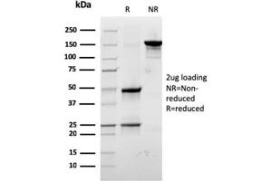 SDS-PAGE (SDS) image for anti-Ribosomal Protein SA (RPSA) antibody (ABIN6939957)