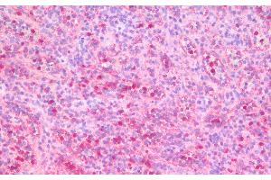 Immunohistochemistry (Paraffin-embedded Sections) (IHC (p)) image for anti-Integrin, alpha X (Complement Component 3 Receptor 4 Subunit) (ITGAX) antibody (ABIN7249394)
