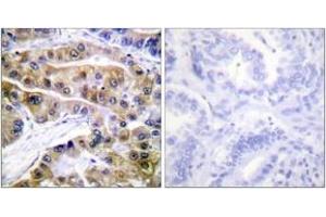 Immunohistochemistry (IHC) image for anti-Dynein, Axonemal, Heavy Chain 8 (DNAH8) (AA 5-54), (pSer16) antibody (ABIN1531300)