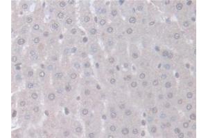 Detection of ITSN1 in Rat Liver Tissue using Polyclonal Antibody to Intersectin 1 (ITSN1) (ITSN1 抗体  (AA 1-227))